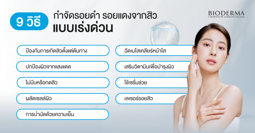 9 วิธีกำจัดรอยดำ รอยแดงจากสิว แบบเร่งด่วน