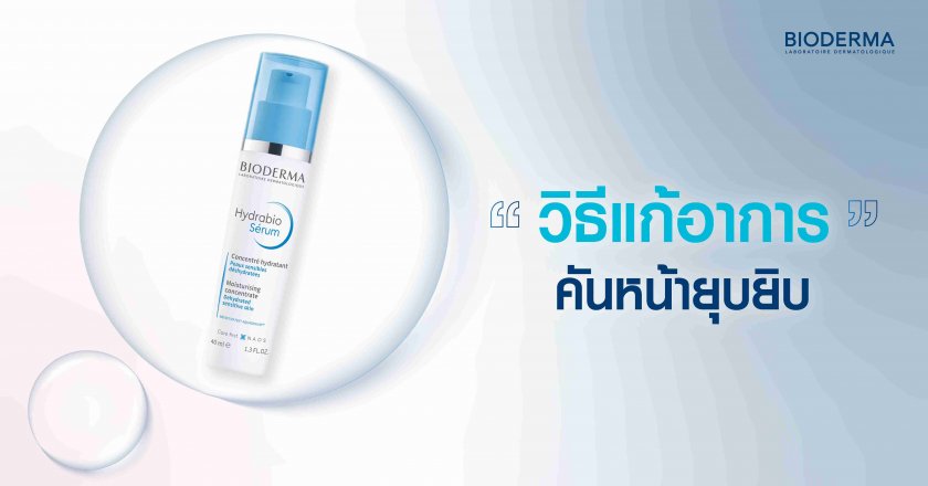 วิธีแก้อาการคันหน้ายุบยิบ