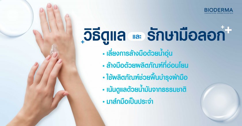วิธีดูแลและรักษามือลอก