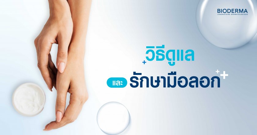 วิธีดูแลและรักษามือลอก