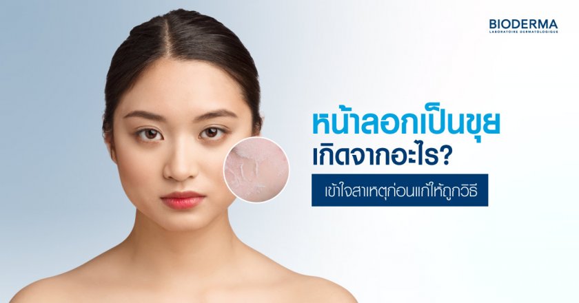 หน้าลอกเป็นขุยเกิดจากอะไร? เข้าใจสาเหตุก่อนแก้ให้ถูกวิธี