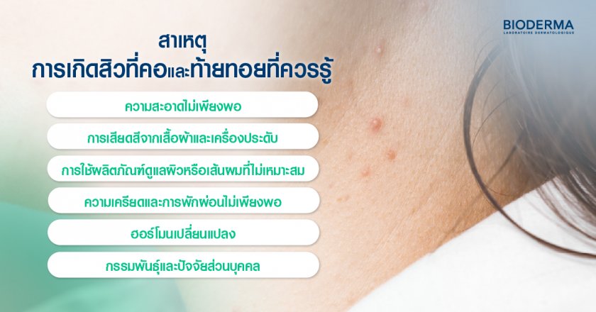 สาเหตุการเกิดสิวที่คอและท้ายทอยที่ควรรู้