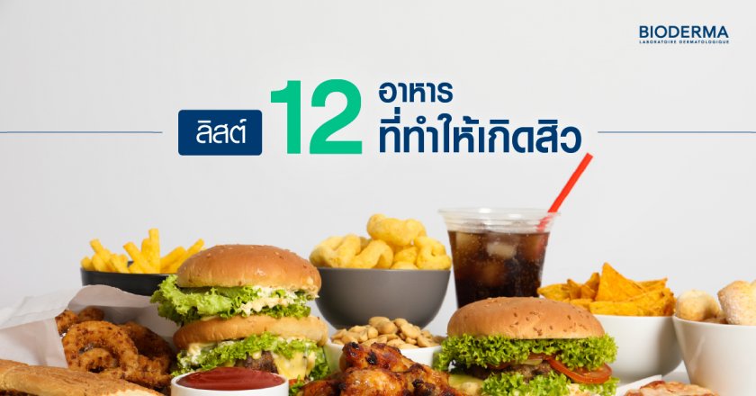 ลิสต์ 12 อาหารที่ทำให้เกิดสิว