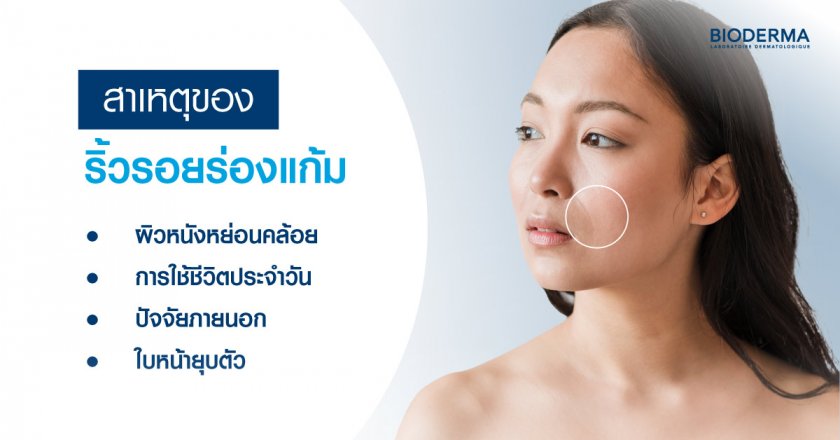 สาเหตุของริ้วรอยร่องแก้ม