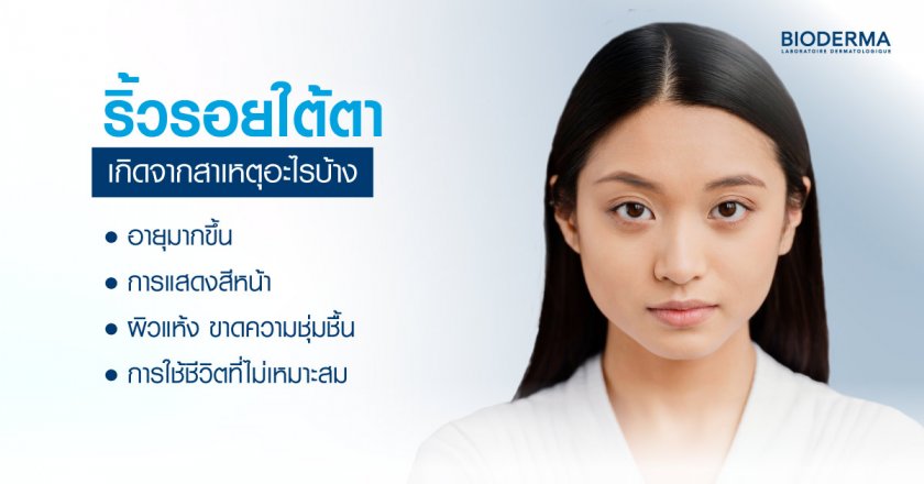 ริ้วรอยใต้ตาเกิดจากสาเหตุอะไรบ้าง
