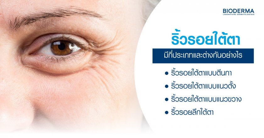 ริ้วรอยใต้ตา มีกี่ประเภทและต่างกันอย่างไร
