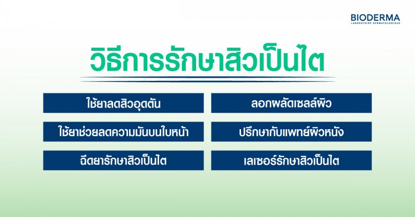 วิธีการรักษาสิวเป็นไต