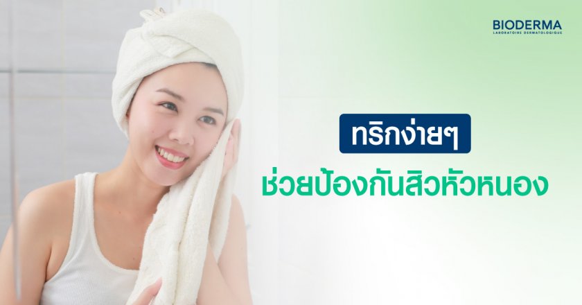 ทริกง่ายๆ ช่วยป้องกันสิวหัวหนอง