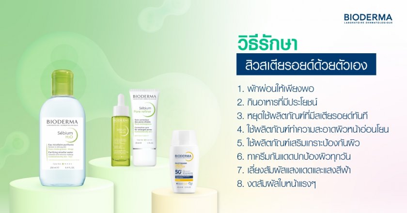 วิธีรักษาสิวสเตียรอยด์ด้วยตัวเอง