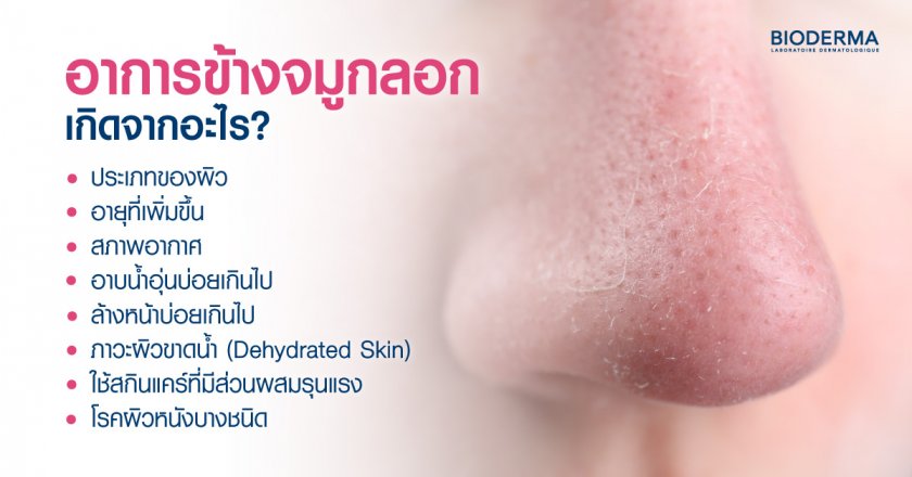 อาการข้างจมูกลอก เกิดจากอะไร?