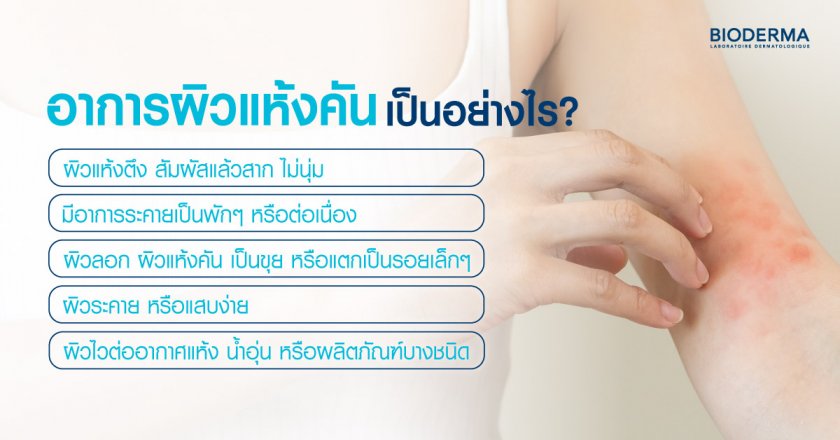 อาการผิวแห้งคัน เป็นอย่างไร?