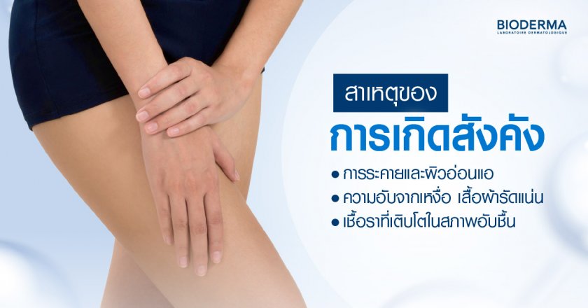 สาเหตุของการเกิดสังคัง