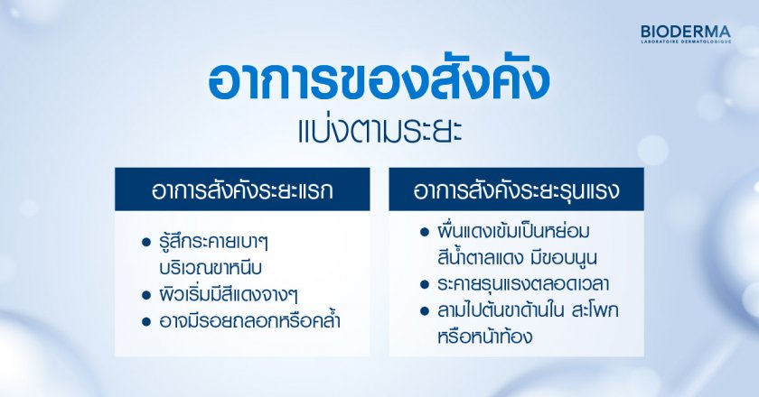 อาการของสังคัง แบ่งตามระยะ