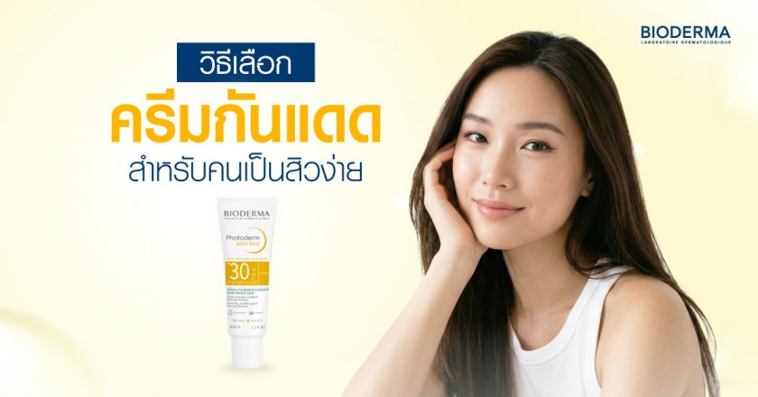วิธีเลือกครีมกันแดดสำหรับคนเป็นสิวง่าย