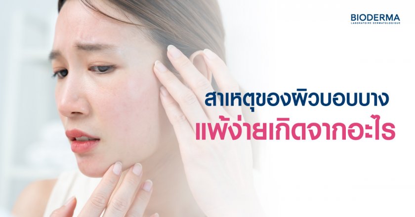 สาเหตุของผิวบอบบาง แพ้ง่ายเกิดจากอะไร