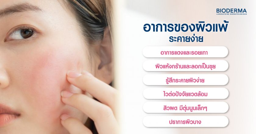 อาการของผิวแพ้ ระคายง่าย