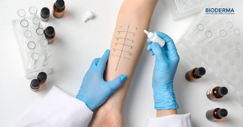 แนะนำ 5 วิธีเลือกสกินแคร์สำหรับผิวบอบบางแพ้ง่าย