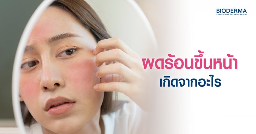 ผดร้อนขึ้นหน้าเกิดจากอะไร