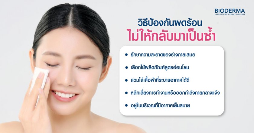 วิธีป้องกันผดร้อน ไม่ให้กลับมาเป็นซ้ำ