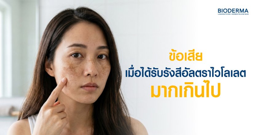 ข้อเสียเมื่อได้รับรังสีอัลตราไวโลเลตมากเกินไป