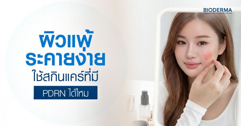 ผิวแพ้ ระคายง่ายใช้สกินแคร์ที่มี PDRN ได้ไหม