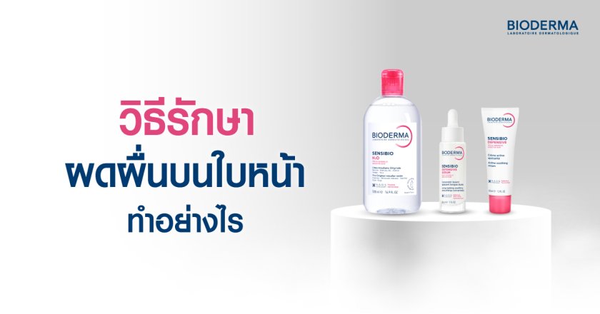 วิธีรักษาผดผื่นบนใบหน้า ทำอย่างไร
