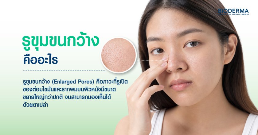 รูขุมขนกว้าง คืออะไร