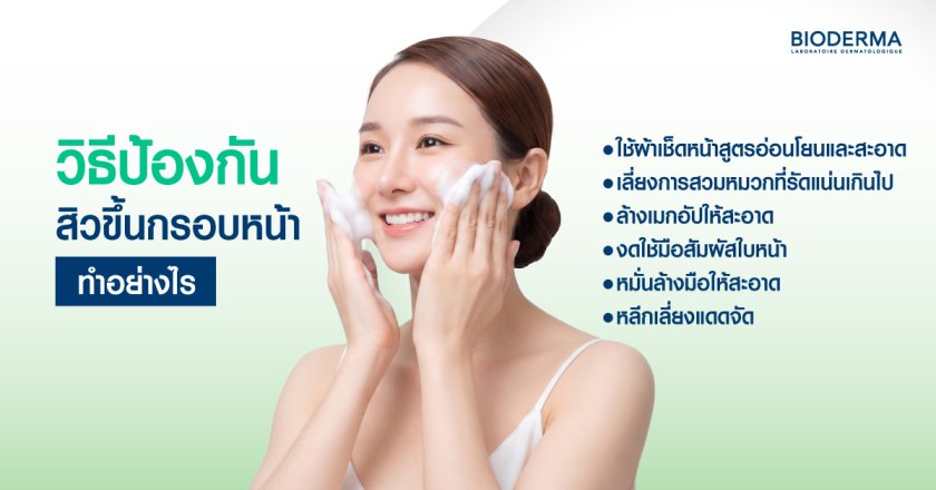 วิธีป้องกันสิวขึ้นกรอบหน้า ทำอย่างไร
