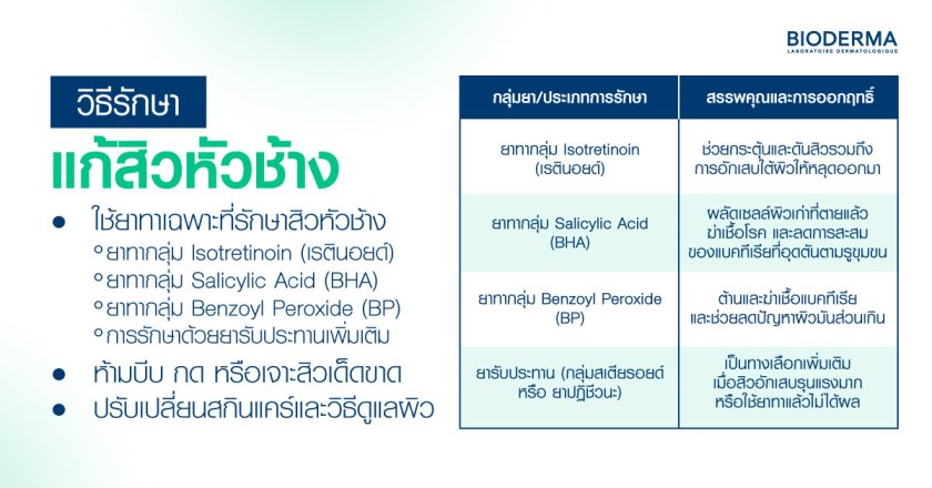 วิธีรักษาแก้สิวหัวช้าง ทำอย่างไร