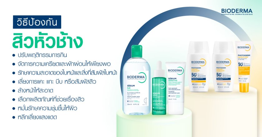 วิธีป้องกันสิวหัวช้าง ไม่ให้กลับมาเป็นซ้ำ