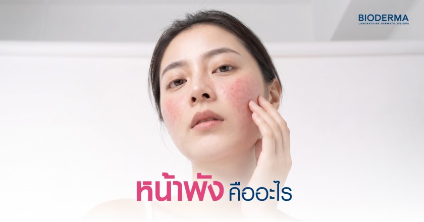 หน้าพัง คืออะไร