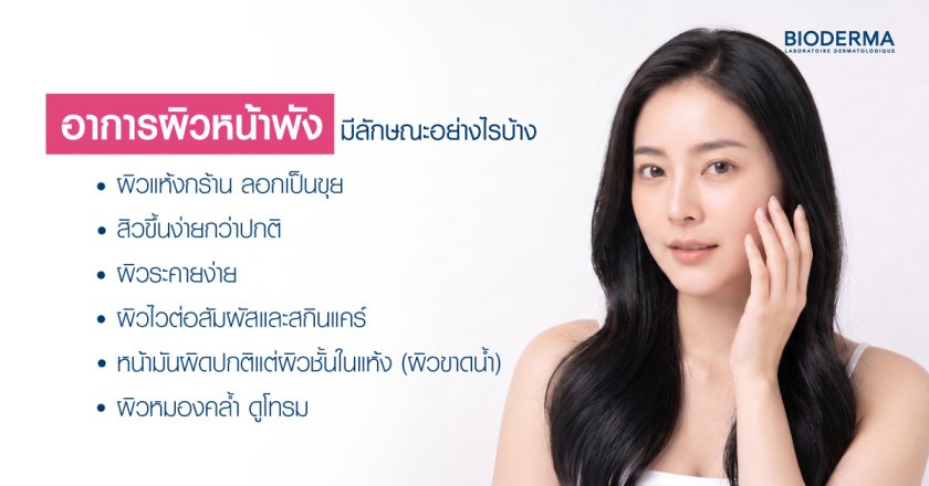 อาการผิวหน้าพังมีลักษณะอย่างไรบ้าง