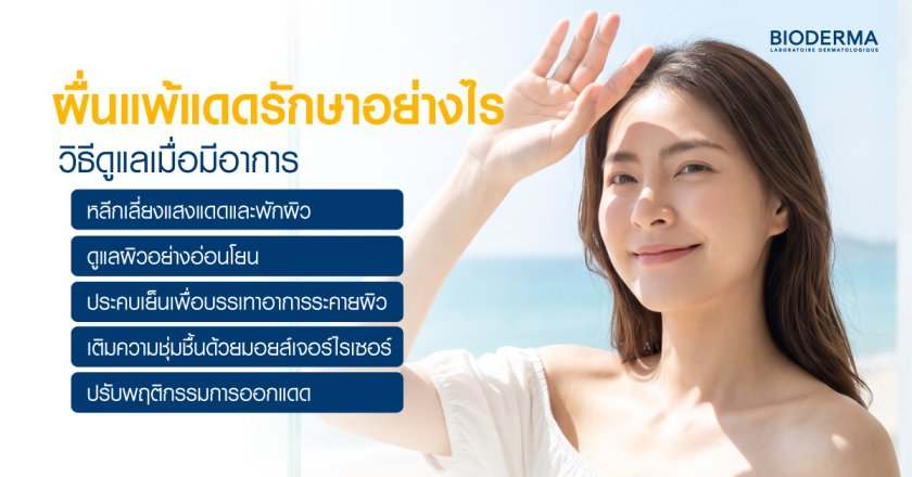 ผื่นแพ้แดดรักษาอย่างไร วิธีดูแลเมื่อมีอาการ