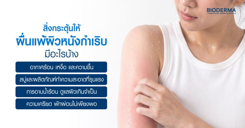 สิ่งกระตุ้นให้ผื่นแพ้ผิวหนังกำเริบ มีอะไรบ้าง