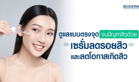 ดูแลแบบตรงจุด จบปัญหาสิวด้วยเซรั่มลดรอยสิวและลดโอกาสเกิดสิว