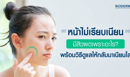หน้าไม่เรียบเนียน มีสิวผดเพราะอะไร? พร้อมวิธีดูแลให้กลับมาเนียนใส