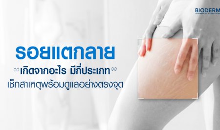 รอยแตก คือรอยที่เกิดจากการยืดหรือหดตัวของผิวหนังอย่างรวดเร็ว จนโครงสร้างเกิดฉีกขาดกะทันหัน เมื่อผิวซ่อมแซมตัวเองจึงขึ้นเป็นเส้นริ้วมีสีต่างกันตามสภาพผิว