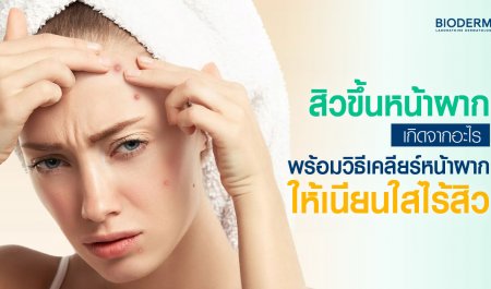 สิวขึ้นหน้าผากเกิดจากอะไร? พร้อมวิธีเคลียร์หน้าผากให้เนียนใสไร้สิว