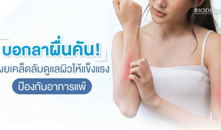 บอกลาผื่นคัน! เผยเคล็ดลับดูแลผิวให้แข็งแรง ป้องกันอาการแพ้