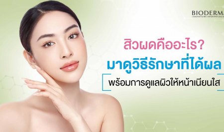 สิวผดคืออะไร? มาดูวิธีรักษาที่ได้ผล พร้อมการดูแลผิวให้หน้าเนียนใส