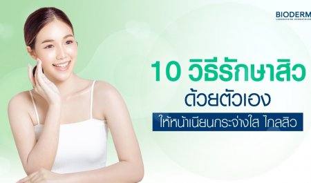 10 วิธีรักษาสิวด้วยตัวเอง ให้หน้าเนียนกระจ่างใส ไกลสิว