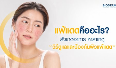 แพ้แดดคืออะไร? สังเกตอาการ หาสาเหตุ วิธีดูแลและป้องกันผิวแพ้แดด