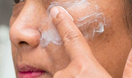 รู้จักชนิดของฝ้า (Melasma) วิธีดูแลรักษาให้หายขาด