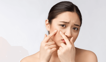 สิวหิน (SYRINGOMA) คืออะไร รักษาอย่างไรให้เห็นผล