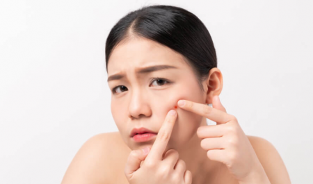 สิวข้าวสาร (Milia) ไม่ใช่สิวหิน! เผยข้อมูลที่หลายคนเข้าใจผิด