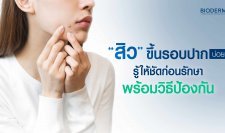 สิวขึ้นรอบปากบ่อยเกิดจากอะไร? รู้ให้ชัดก่อนรักษา พร้อมวิธีป้องกัน