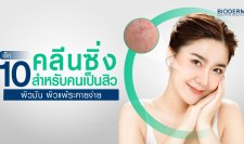 เช็ก 10 เหตุผลที่ต้องใช้คลีนซิ่งสำหรับคนเป็นสิว ผิวมัน ผิวแพ้ระคายง่าย