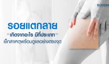 รอยแตก คือรอยที่เกิดจากการยืดหรือหดตัวของผิวหนังอย่างรวดเร็ว จนโครงสร้างเกิดฉีกขาดกะทันหัน เมื่อผิวซ่อมแซมตัวเองจึงขึ้นเป็นเส้นริ้วมีสีต่างกันตามสภาพผิว