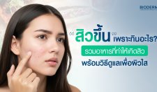 สิวขึ้นเพราะกินอะไร? รวมอาหารที่ทำให้เกิดสิว พร้อมวิธีดูแลเพื่อผิวใส