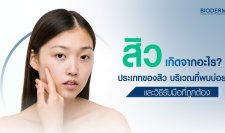 สิวเกิดจากอะไร? ประเภทของสิว บริเวณที่พบบ่อย และวิธีรับมือที่ถูกต้อง